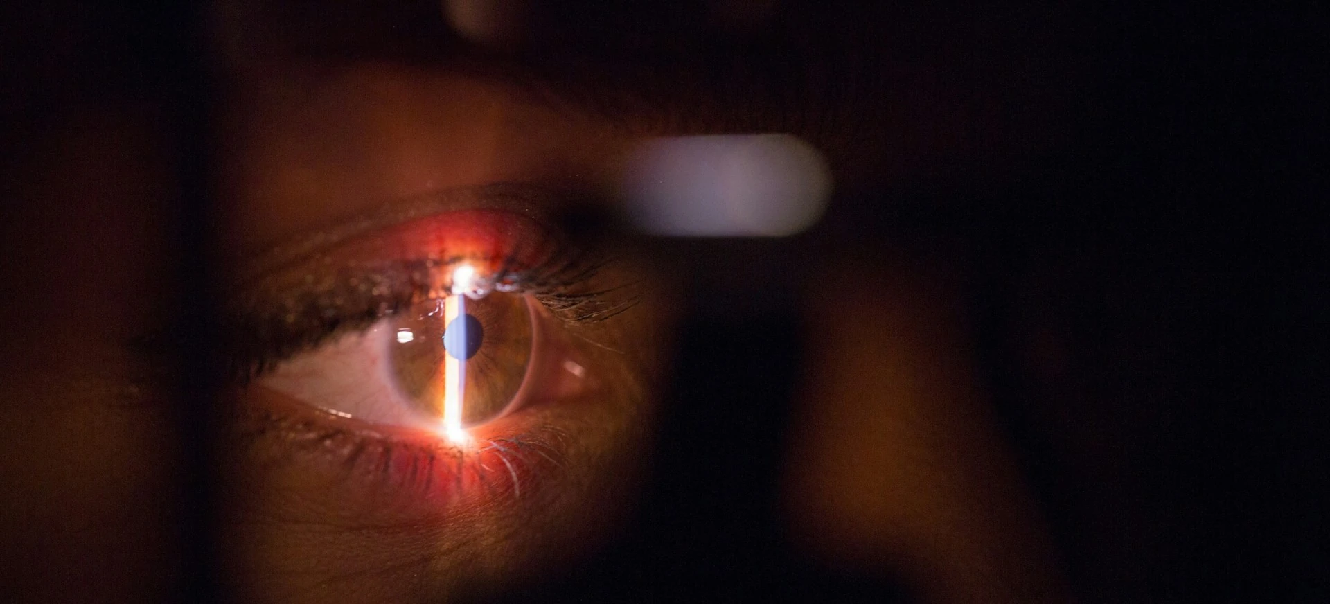 Close-up of an eye lit by a slit lamp beam during a detailed eye health check.