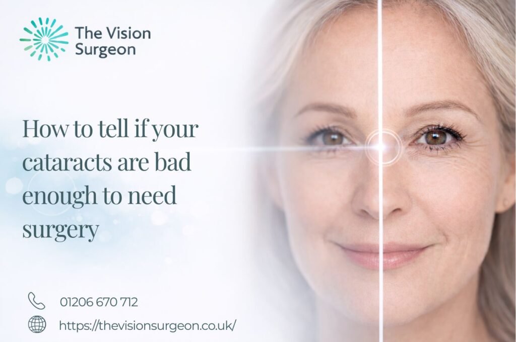 How to tell if your cataracts are bad enough to need surgery The Vision Surgeon
