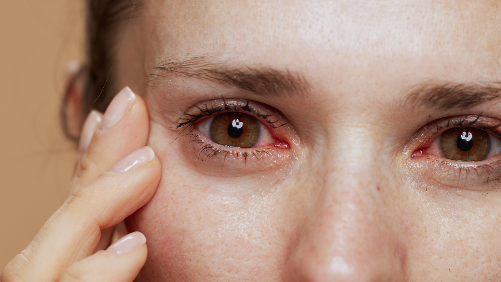 Eye Pain Causes and Treatment Options