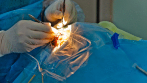 Eye Problems After Cataract Operation and Their Solutions
